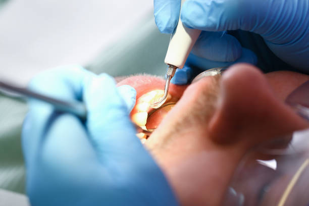 Best Weekend Emergency Dentist in Briarcliff, TX