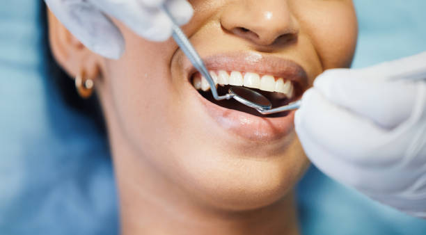 Best Emergency Wisdom Teeth Removal in Briarcliff, TX