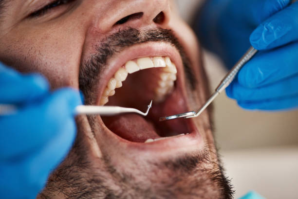 Best Emergency Dental Care for Broken or Chipped Teeth in Briarcliff, TX